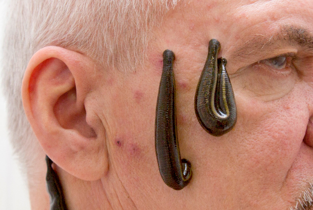 leech woman leech woman